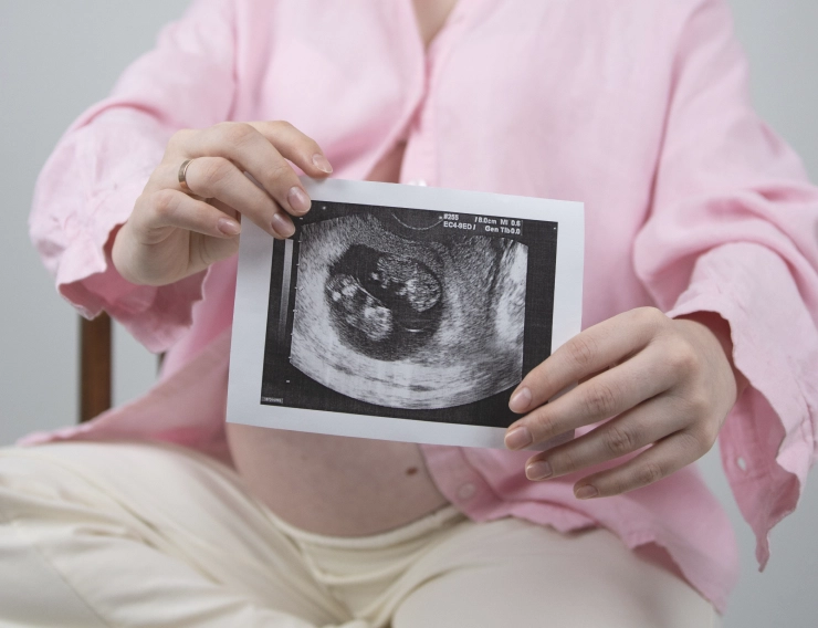 Фотогалерея